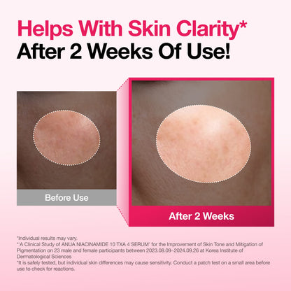 Niacinamide 10 TXA 4 Serum for Brightening and Dark Spots