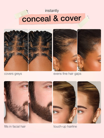 🔥Last Day Buy 1 Get 1 Free🔥shape tape™ dab & go hair concealer